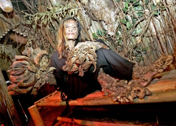 Some Rarest Diseases That You Have Never Heard