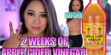 Weight Loss With Apple Cider Vinegar: Does It Really Work?