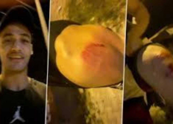 Asim Riaz Attacked – Sad News For His Fans