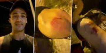 Asim Riaz Attacked – Sad News For His Fans