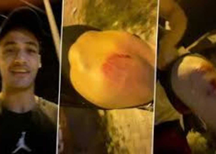 Asim Riaz Attacked – Sad News For His Fans